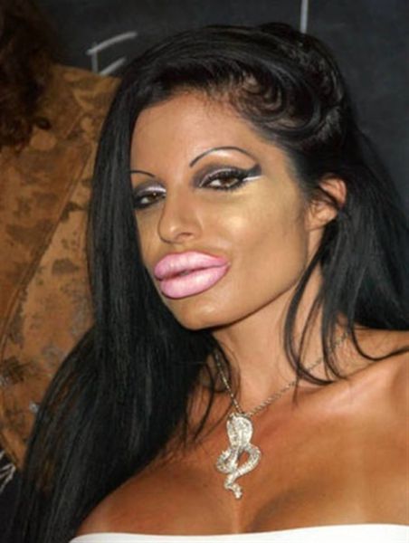 when_plastic_surgery_goes_really_wrong_640_09