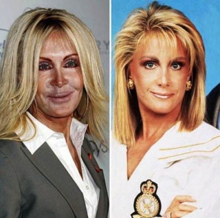 the_horrors_of_terrible_plastic_surgery_29