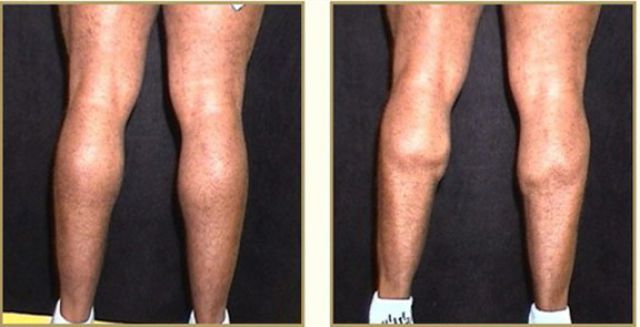 when_plastic_surgery_goes_really_wrong_640_07