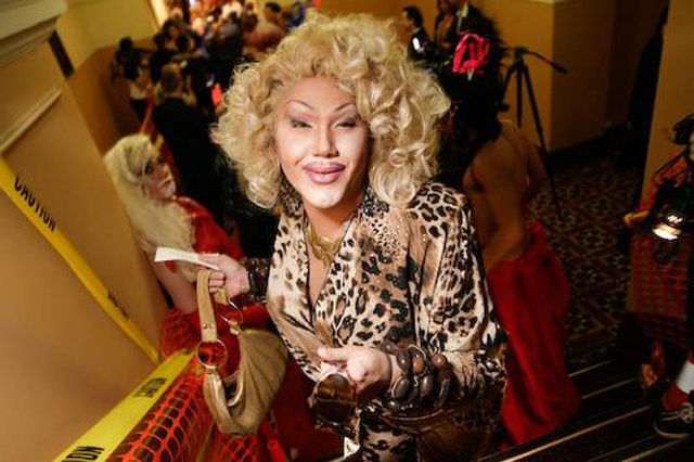 when_plastic_surgery_goes_really_wrong_640_31