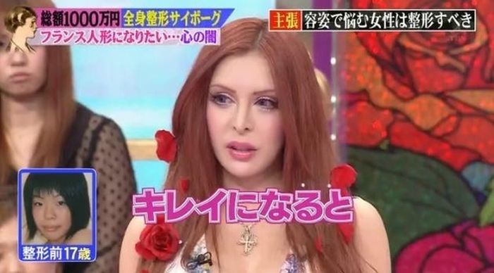 japanese_woman_gets_plastic_surgery_08