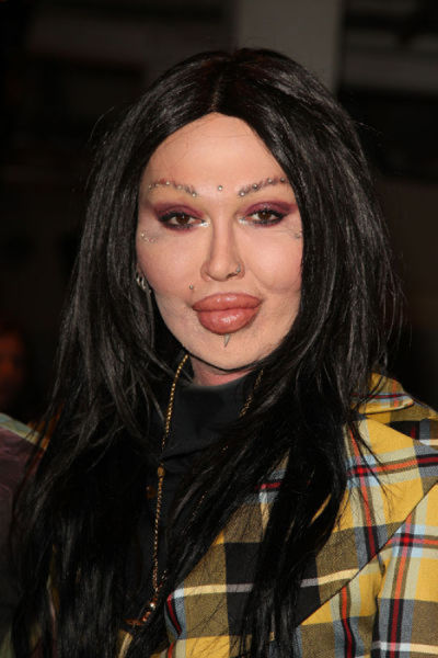 when_plastic_surgery_goes_really_wrong_640_14