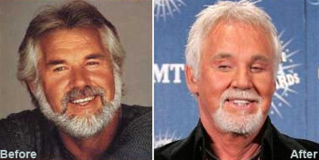 when_plastic_surgery_goes_really_wrong_640_06