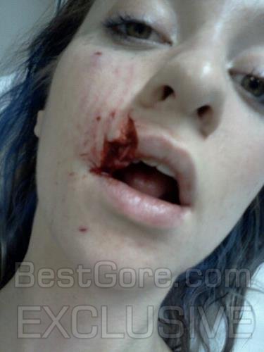 girl-bit-by-dog-in-face-best-gore-exclusive-02