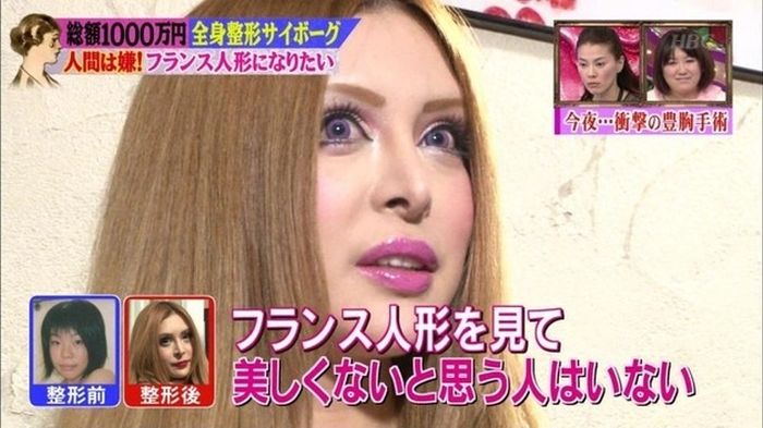 japanese_woman_gets_plastic_surgery_09