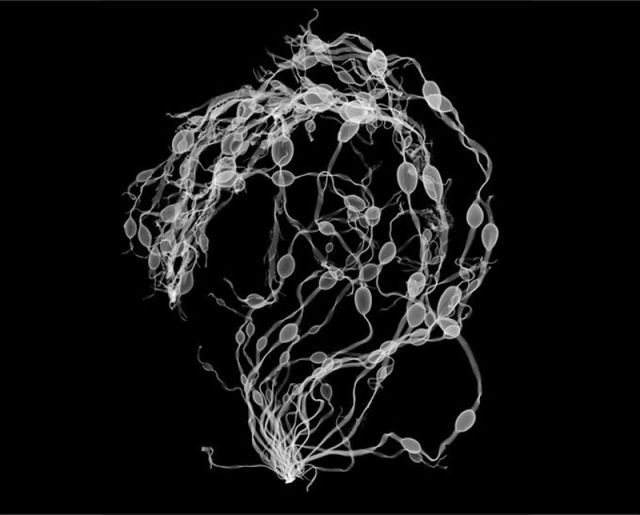 amazing_xray_artwork_640_34