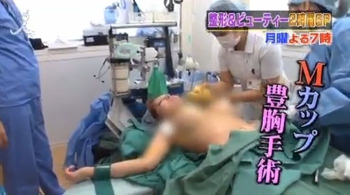 japanese_woman_gets_plastic_surgery_10